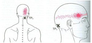 Post C web diagram