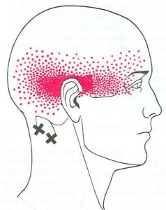 Suboccipital web diagram