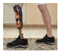 phantom-pain
