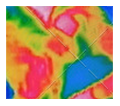 thermal-breast-imaging
