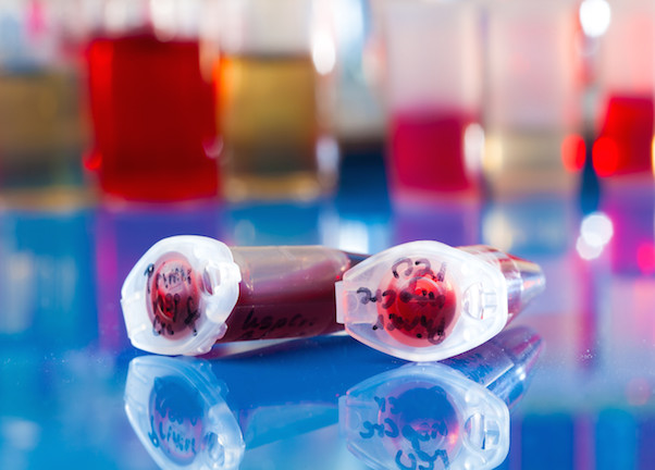 stem cell vials