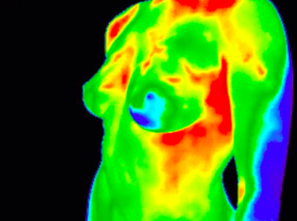 breast thermography