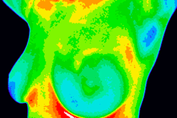 How to Make the Most of Your Thermography Screening